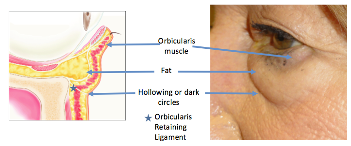 A diagram showing the relative positions of the orbicularis muscle system.